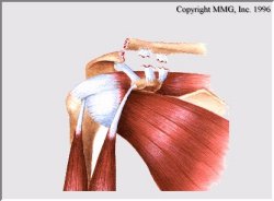 Shoulder Separated